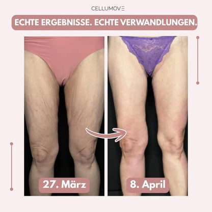 Firmer, smoother legs in 14 days — for women tired of being held back by sagging skin