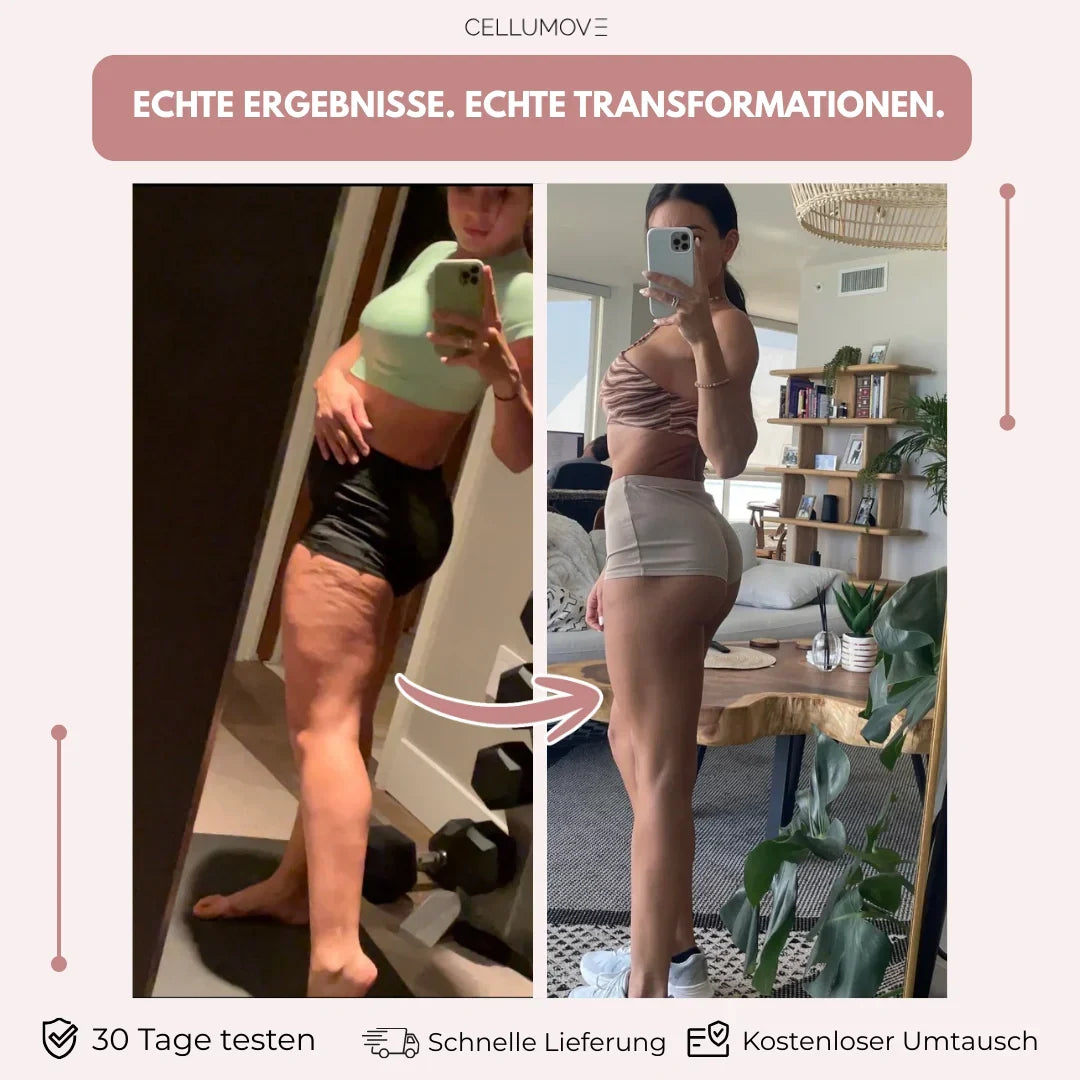 Anti-Cellulite-Leggings